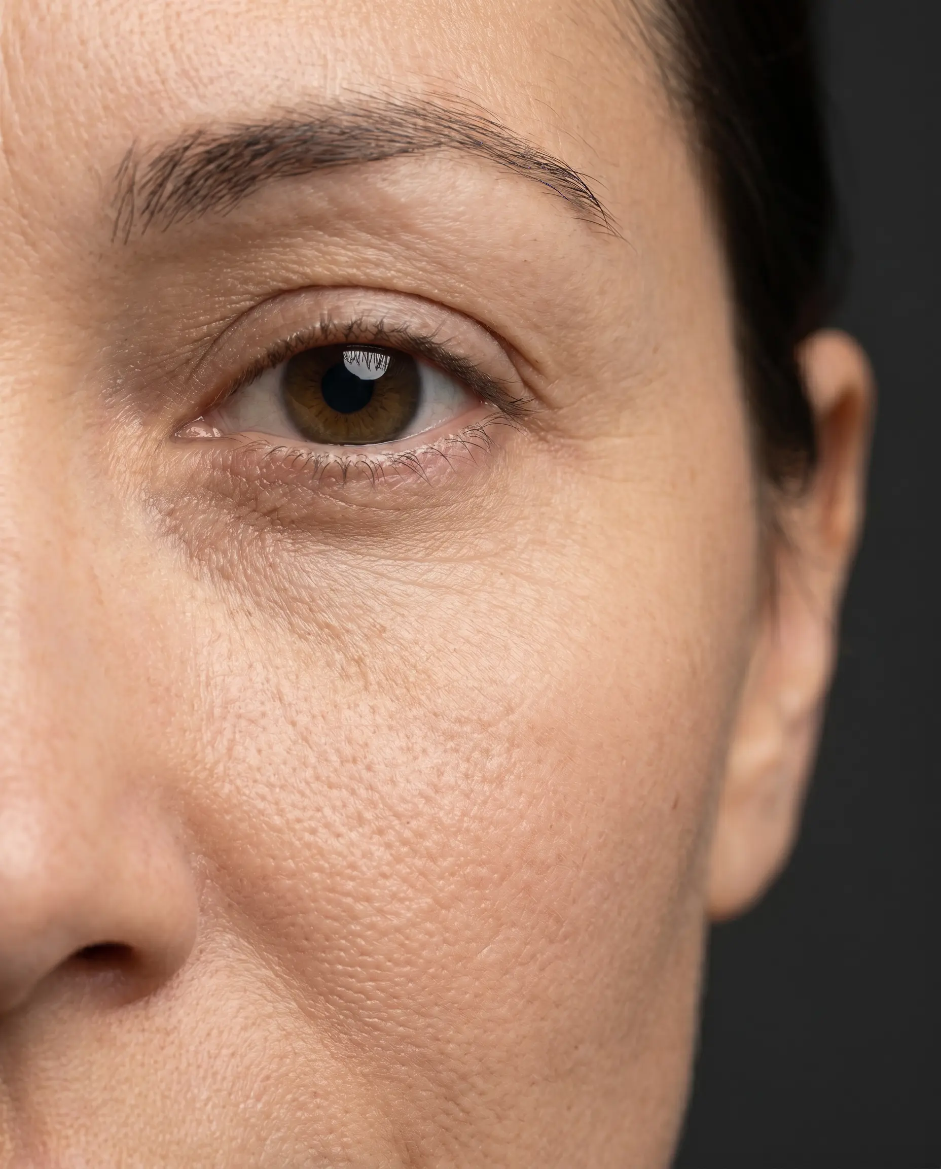 Close-up of facial skin showing fine lines and early signs of collagen thinning